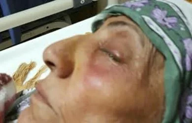 توضیحات معاون دانشگاه علوم پزشکی قم درباره تراژدی درمانگاه چشم پزشکی