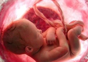 پروانه کار پزشکان خاطی در سقط جنین ابطال می‌شود