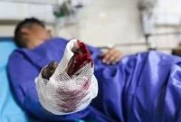قطع مچ دست یک نفر در حادثه چهارشنبه سوری قم